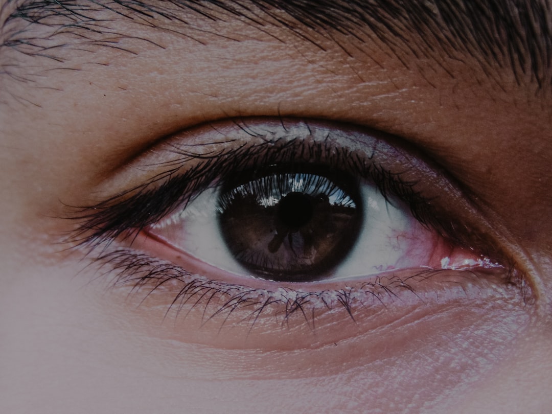 How Much Does Laser Conjunctival Naevus Removal Cost in the UK