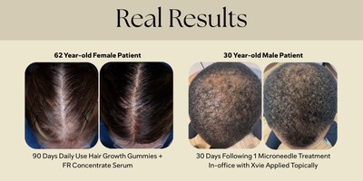 Xtressé™ Launches the First Stress-Adaptive Hair Therapy System Combining At-Home Daily Ritual with an Exclusive Medical Practice Treatment